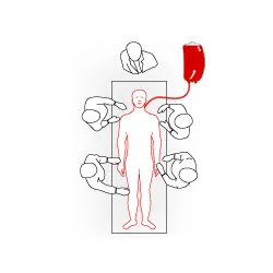 Step 3: Re-infusing concentrated whole blood quickly back to the patient